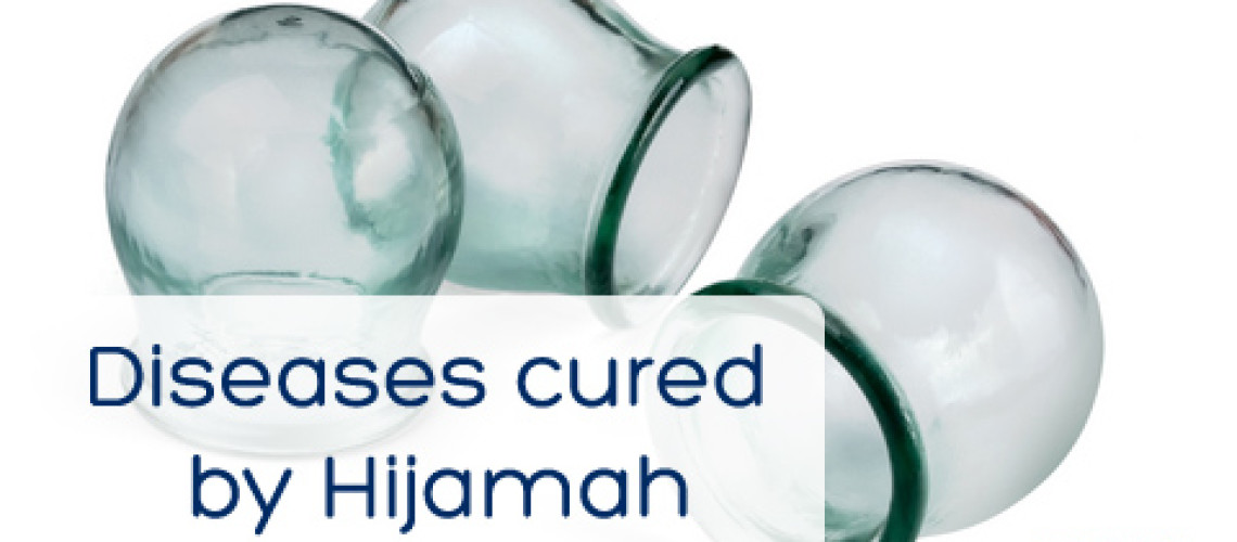 Diseases Cured by Hijama